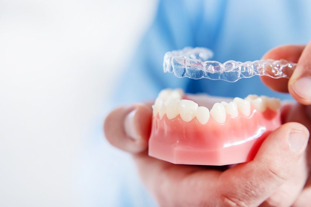 The doctor puts transparent aligners on the teeth of an artificial jaw close up